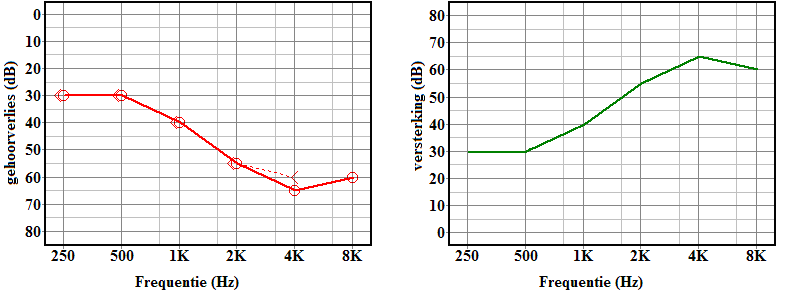 spiegelaudiogram